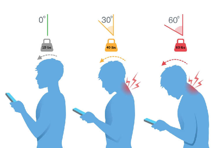 The Hidden Link Between Posture and Pain – and How Spinal Decompression Can Help
